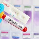 ratusan-ribu-alat-rapid-test-corona-masuk-indonesia-ini-cara-kerjanya